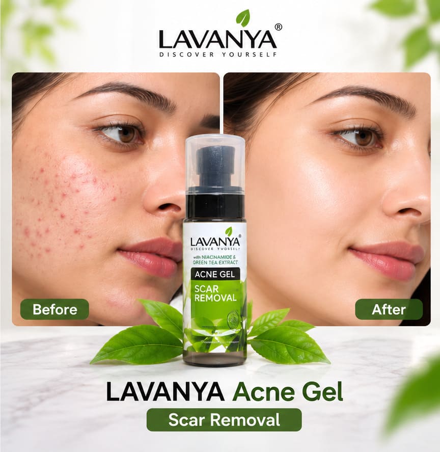 before after results after using lavanya acne gel